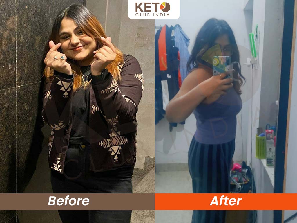 Shivani KCI Transformations